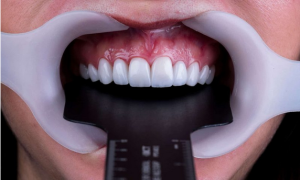 آموزش عکاسی دندانپزشکی